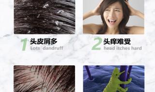 生长头发的洗发露 生长头发的洗发露